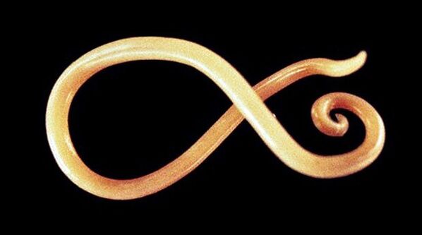 crv nematoda iz ljudskog tijela